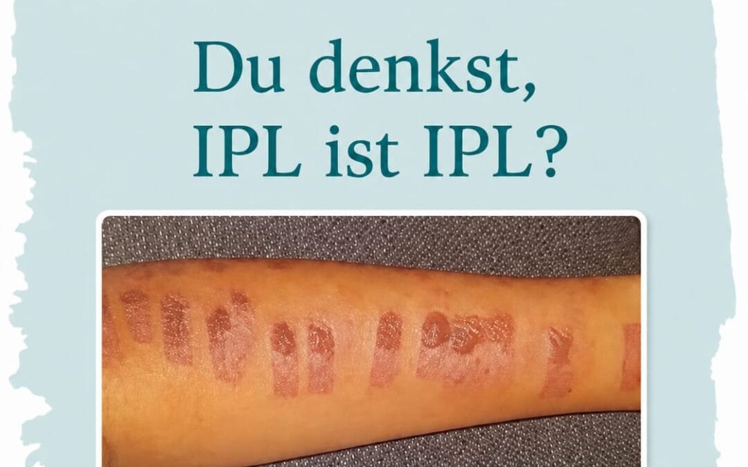 Haarentfernung – Bevor du buchst: Dieses Foto solltest du sehen